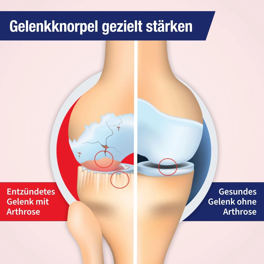 Gelencium® arthro