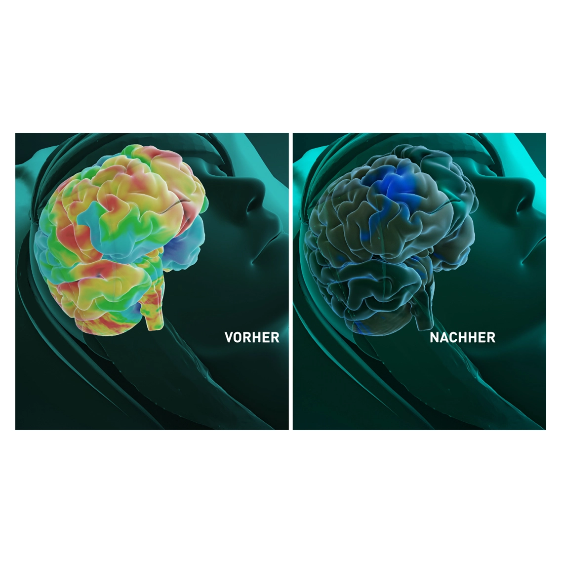 Dreamolino Night Guard Bettüberzug zum Schutz vor Elektrosmog 90x200cm